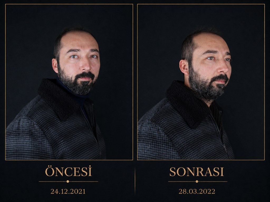 Öncesi / Sonrası 6