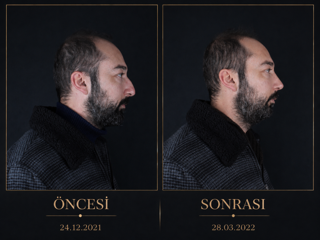 Öncesi / Sonrası 7